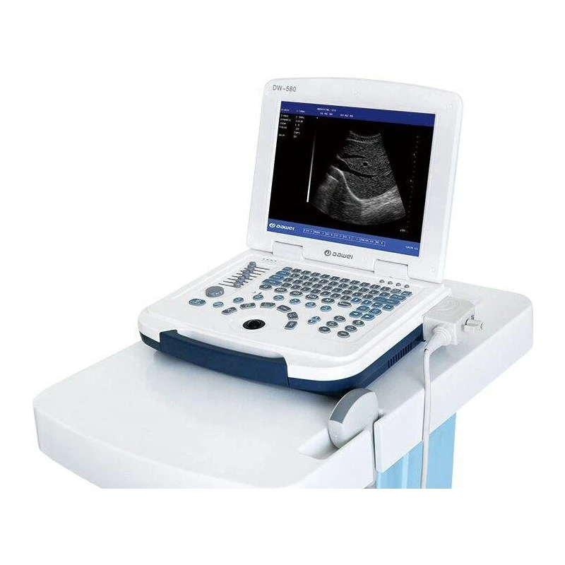 DW-580 напълно дигитална ултразвукова диагностика ръчно ултразвуков скенер mindray machine порцелан