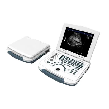 DW-580 напълно дигитална ултразвукова диагностика ръчно ултразвуков скенер mindray machine порцелан